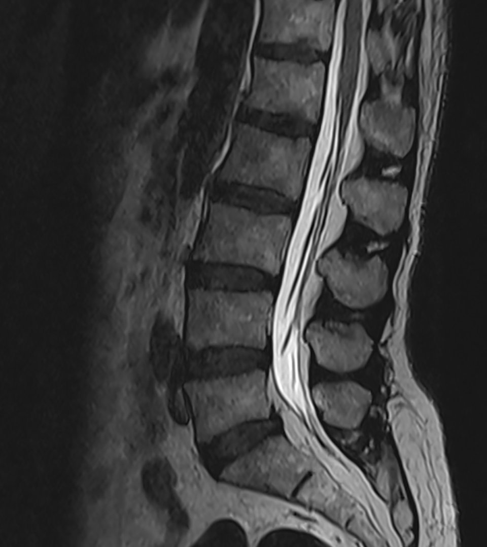 IRM, radiographie, scanner et imagerie spécifique Lorient ...